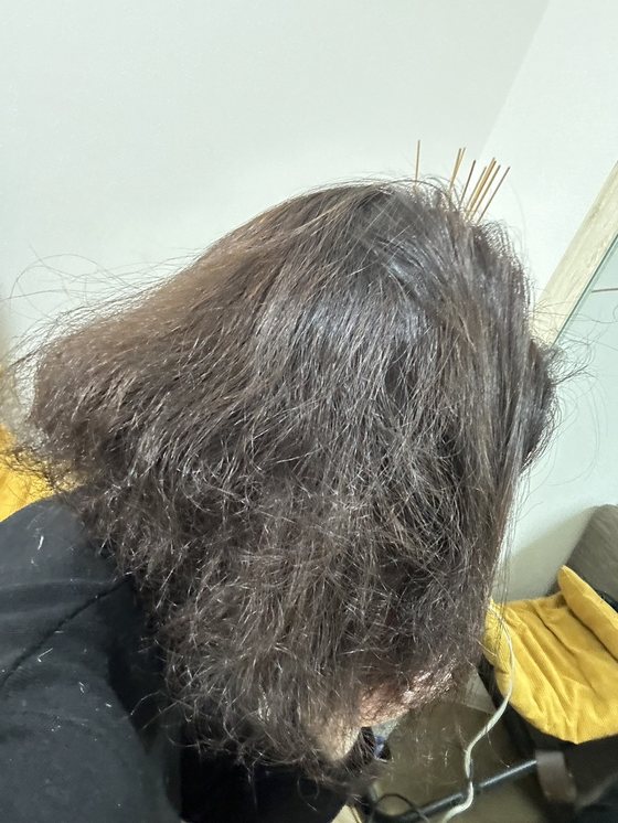 施術前